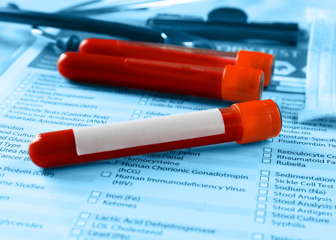 Lab Tests Services